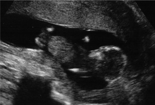 Baby 12 weeks 4 days