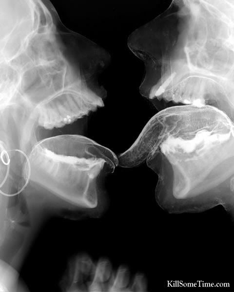 57537xraykiss.jpg